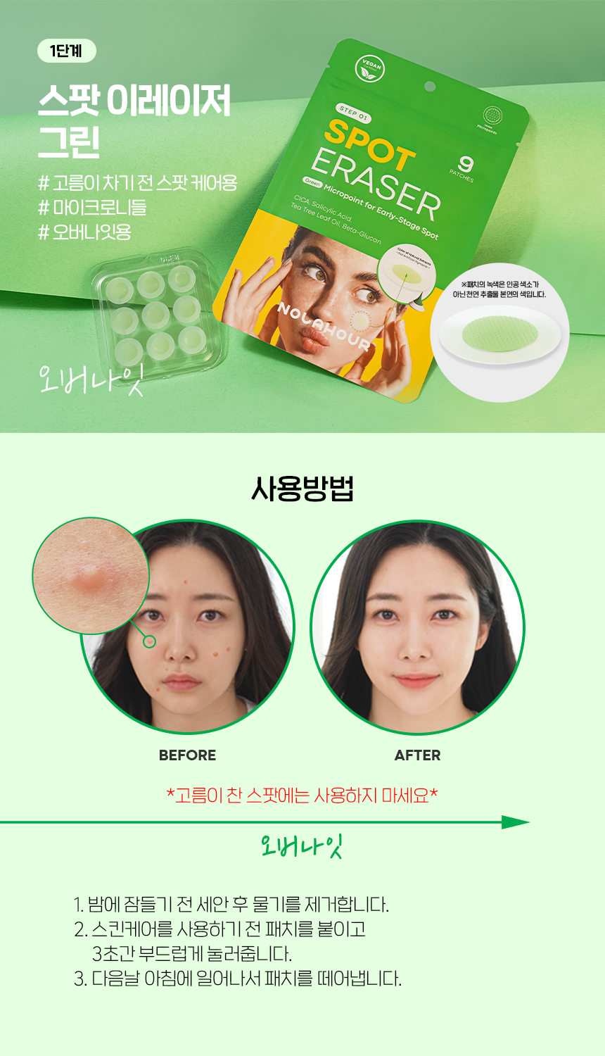 NOLAHOUR-Spot Eraser Green 9 unidades,