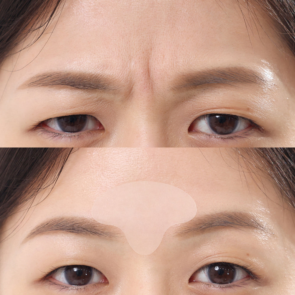 🌙 MADFORCOS «Wrinkle Master Patch» Parches Antienvejecimiento
