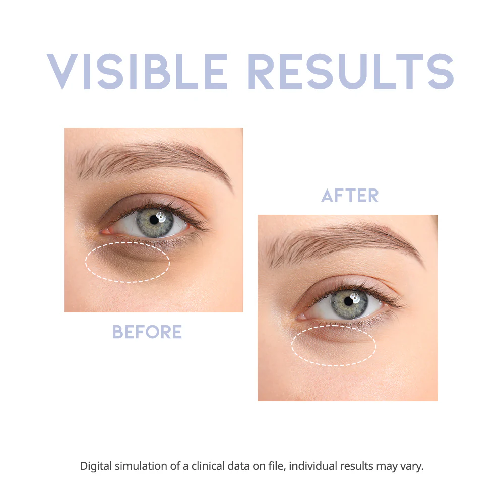 ✨ OOTD Sérum «Intensive Eye Serum» – Cuidado intensivo para una mirada radiante ✨ 30G