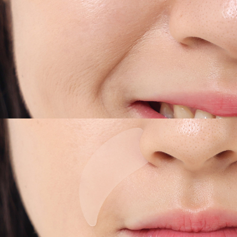 🌙 MADFORCOS «Wrinkle Master Patch» Parches Antienvejecimiento