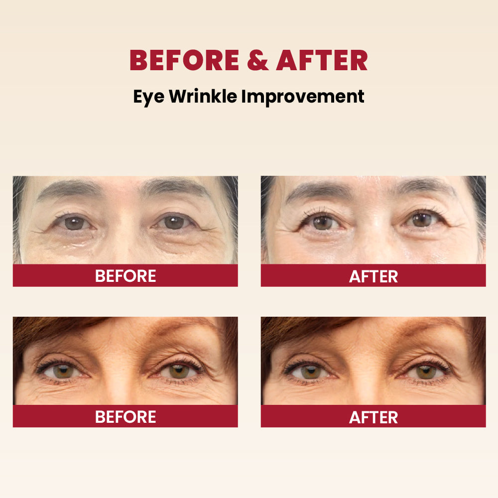 K-SECRET 🌟 SEOUL 1988 Eye Cream : Retinal Liposome 4% + Fermented Bean